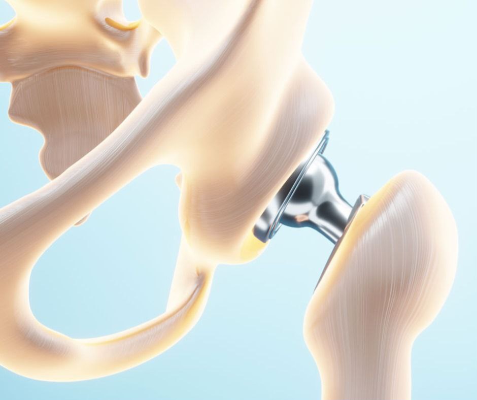 IMG_20250819_093611_733.jpg IMG_20250819_093611_733.jpg